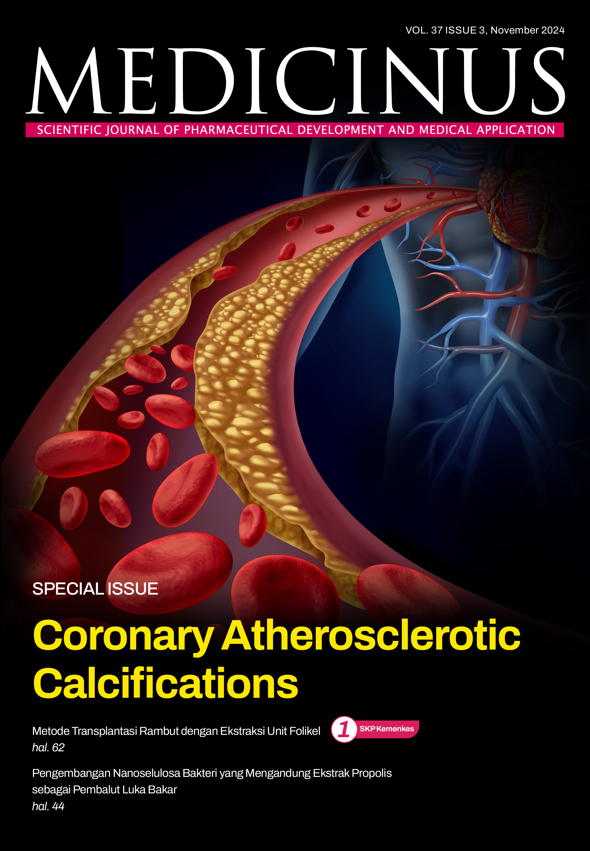 							Lihat Vol 37 No 3 (2024): MEDICINUS
						