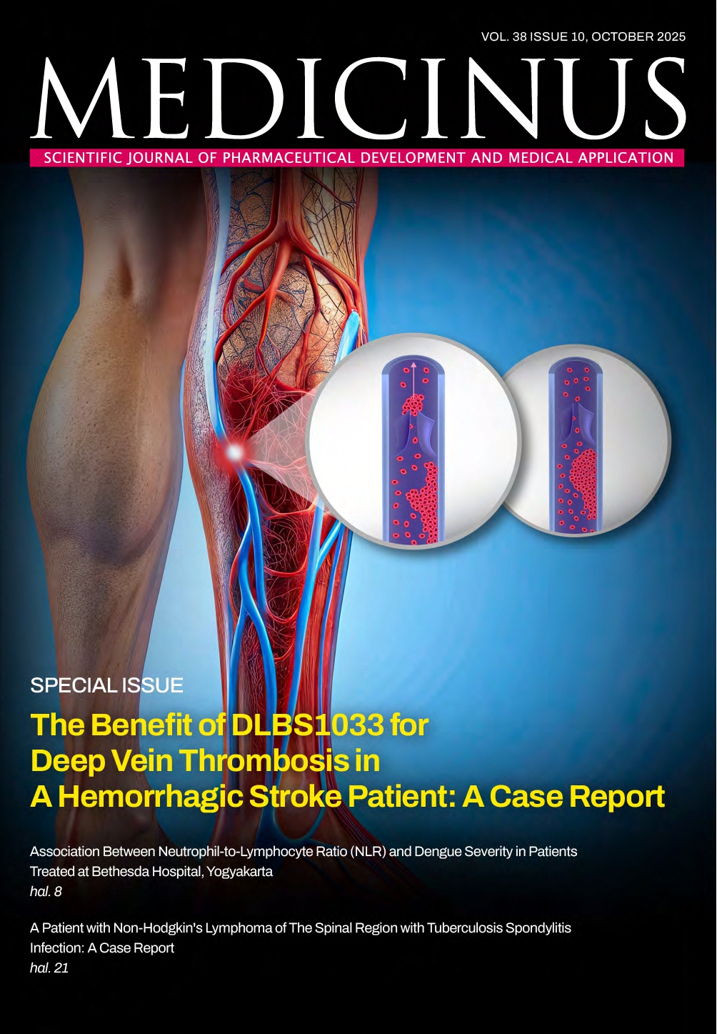 							Lihat Vol 38 No 10 (2025): MEDICINUS
						